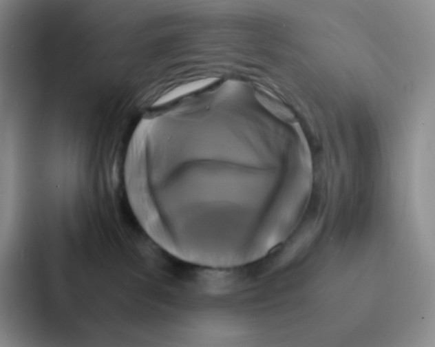 X0000086920139200705141730
