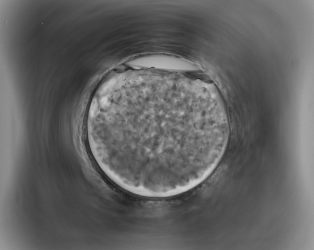 X0000086920145200705141729
