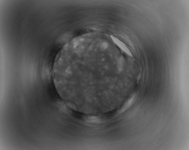X0000086920285200705141728