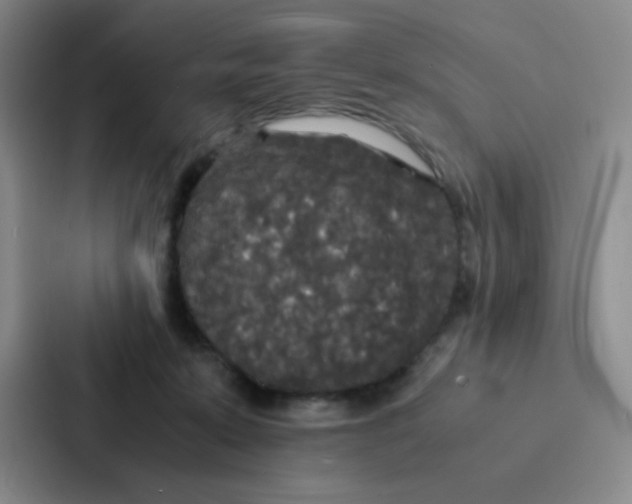 X0000086920319200705141727