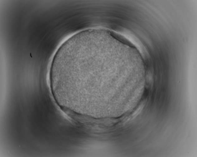 X0000086920959200705141720