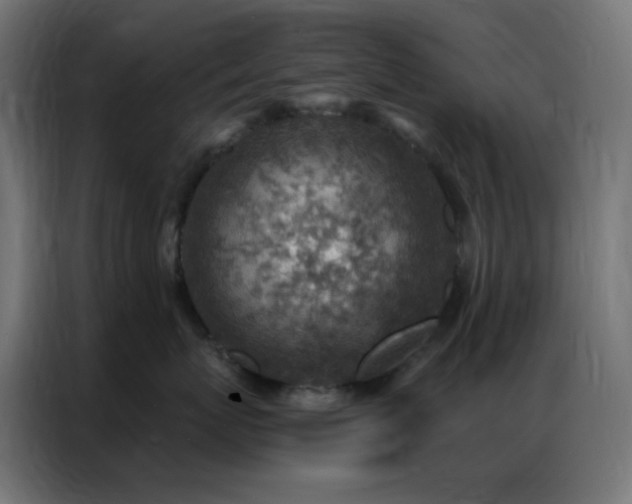 X0000086930767200704161424