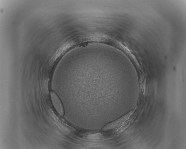 X0000086930154200704231339