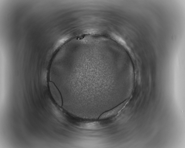 X0000086930154200704301124