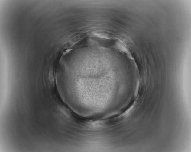 X0000086930186200704301124