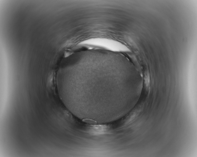 X0000086930233200704301123