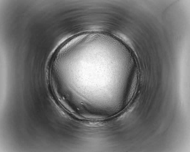 X0000086930835200704301115