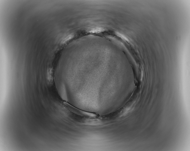 X0000086931156200704301111