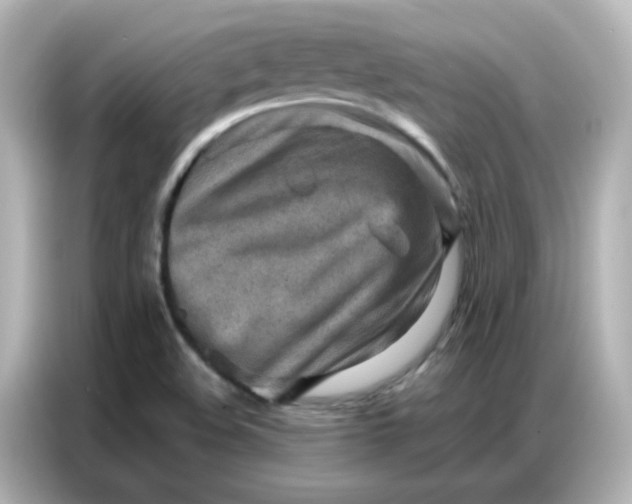 X0000086931508200704301107