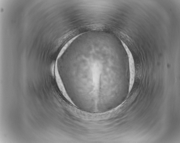 X0000086930047200705071404