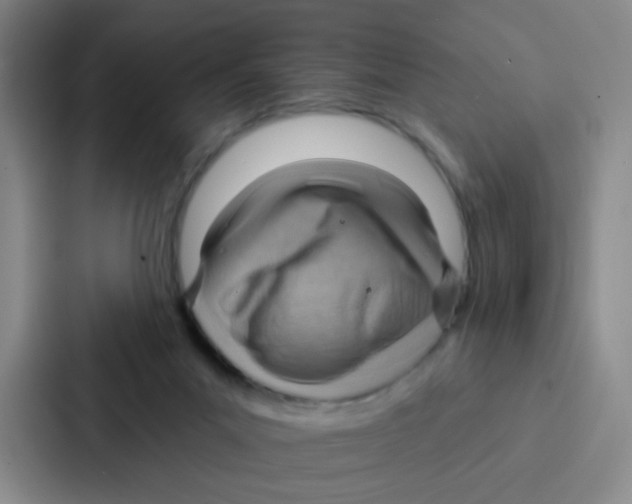 X0000086930023200705141751