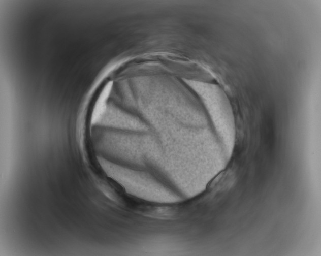 X0000086930056200705141750