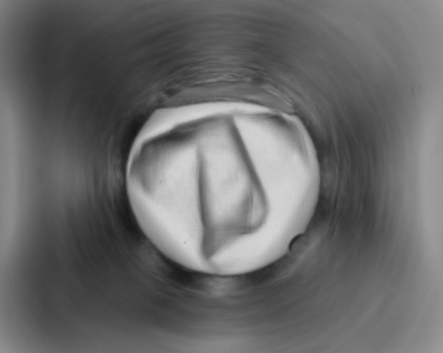 X0000086930085200705141751