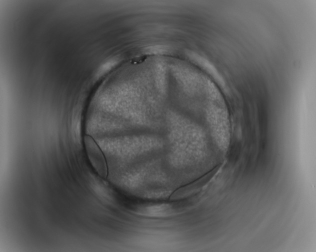 X0000086930154200705141749