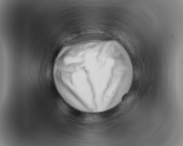 X0000086930185200705141749