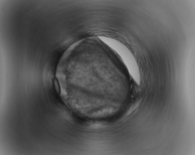 X0000086930235200705141748