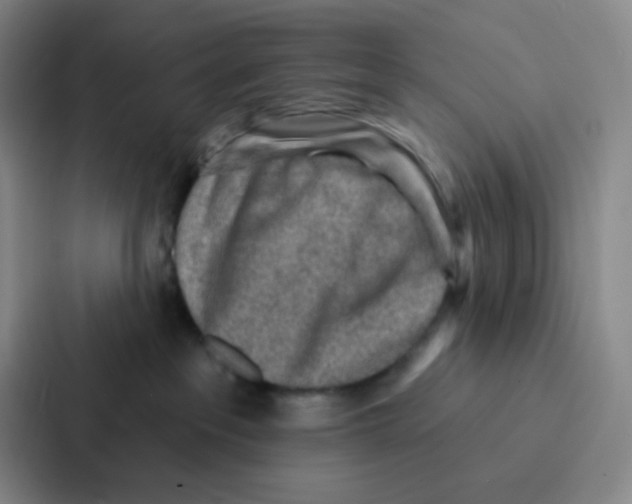 X0000086930237200705141748