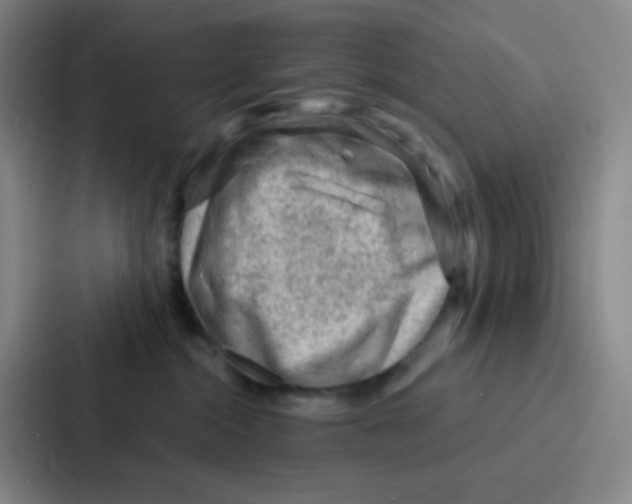 X0000086930284200705141748