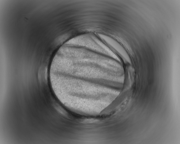 X0000086930397200705141746