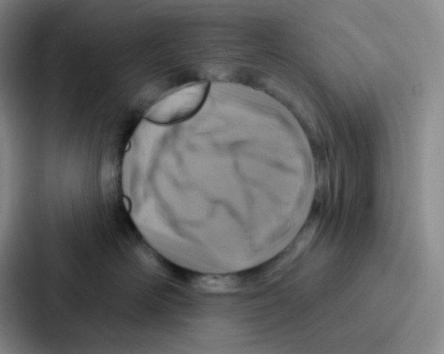 X0000086930526200705141745