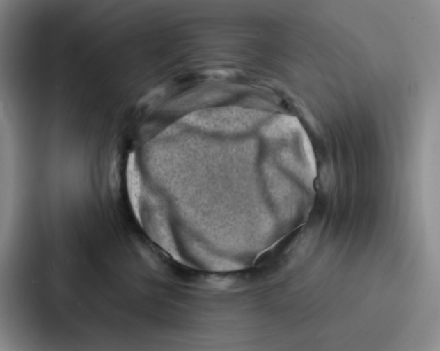 X0000086930570200705141744