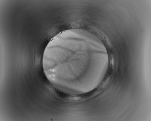 X0000086930610200705141744