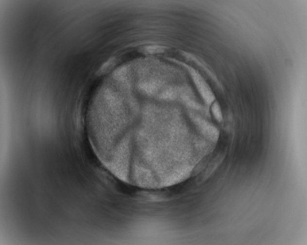 X0000086930763200705141742