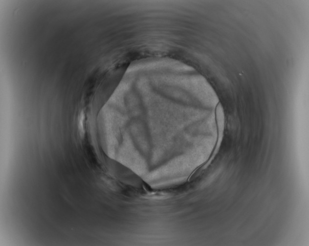 X0000086930818200705141740