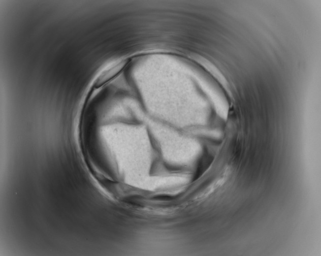 X0000086931197200705141736