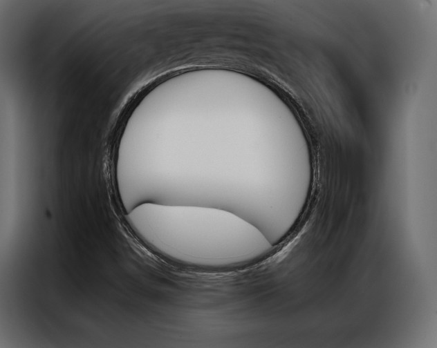 X0000086941498200704161023