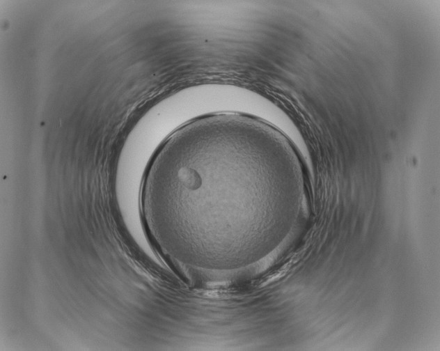 X0000086940564200704231400