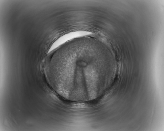 X0000086940428200704301141