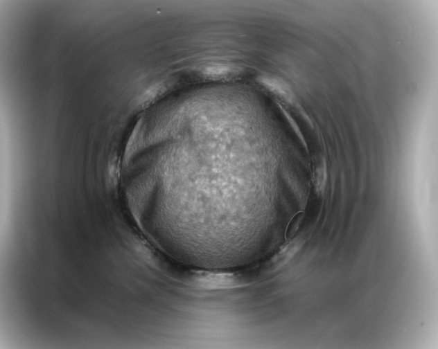 X0000086940476200704301141