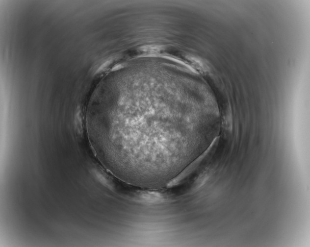 X0000086940572200704301139