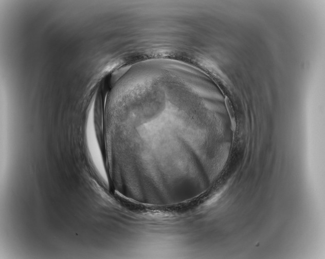 X0000086940585200704301139