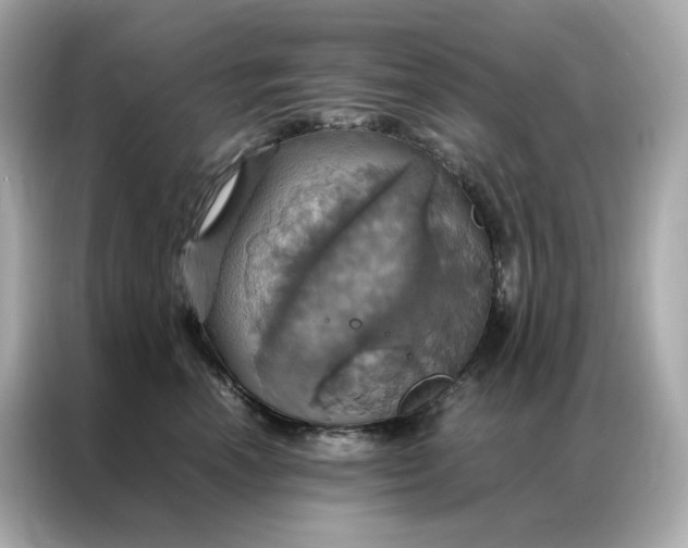 X0000086940666200704301138