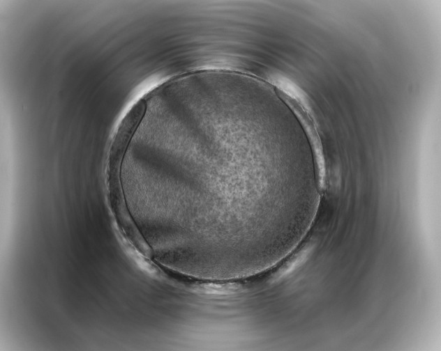 X0000086941138200704301132