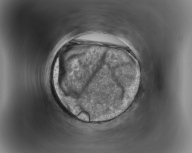 X0000086940007200705141811