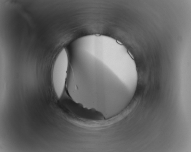 X0000086940027200705141811