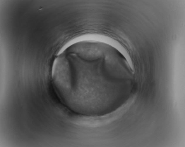 X0000086940029200705141811