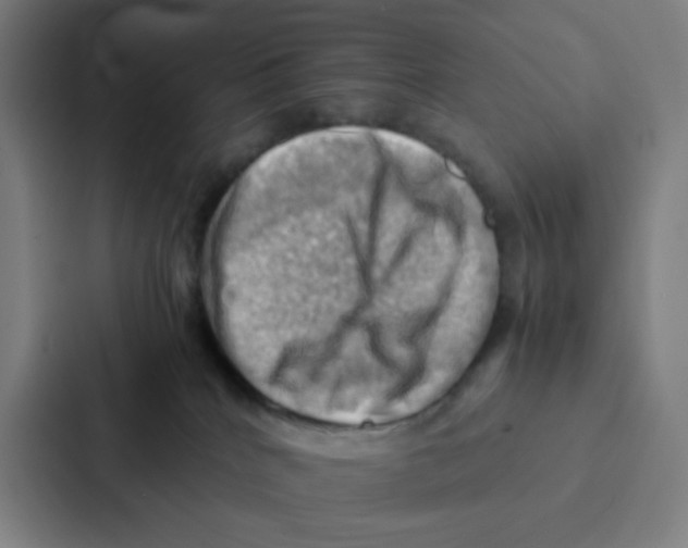 X0000086940040200705141811