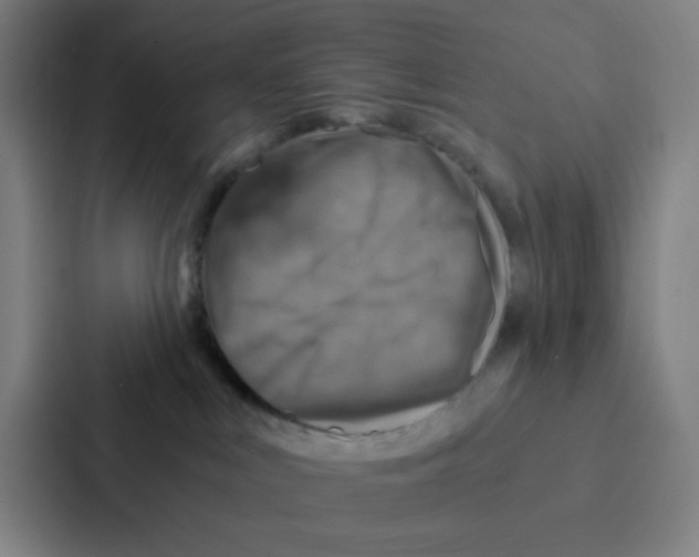 X0000086940043200705141811