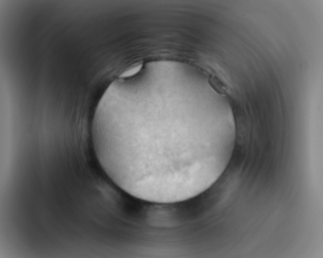 X0000086940077200705141810