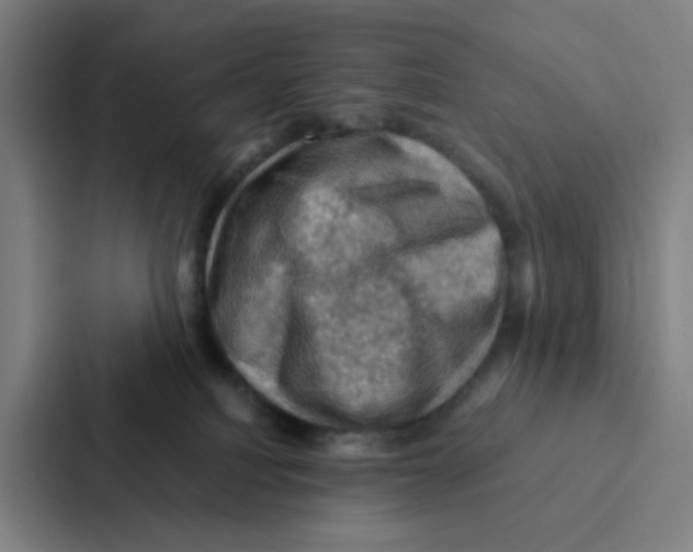 X0000086940088200705141811