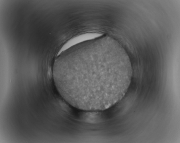 X0000086940089200705141811