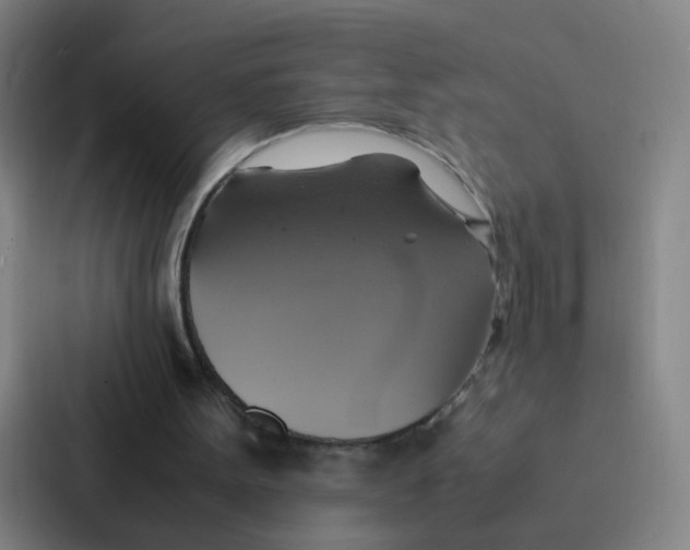 X0000086940099200705141810