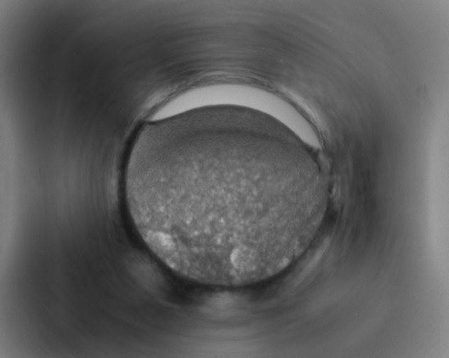 X0000086940111200705141810