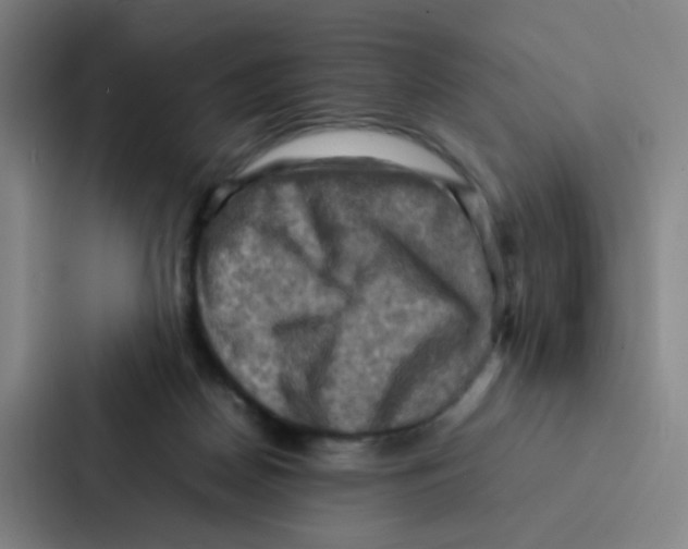X0000086940170200705141809