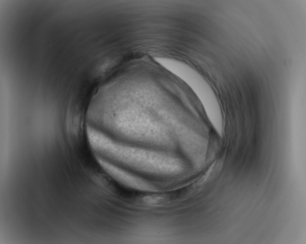 X0000086940172200705141809