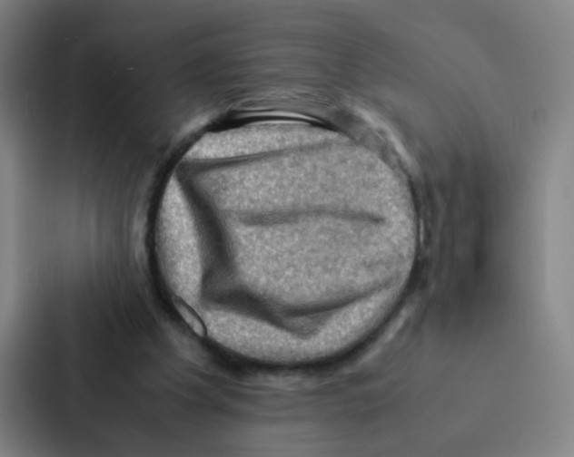 X0000086940201200705141809